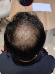 -雍禾植发全国连锁