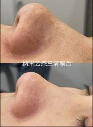 -SKIN79皮肤管理中心
