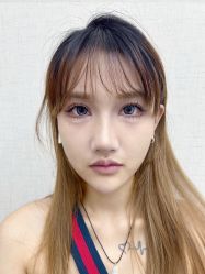 体验前-深圳艺星医疗美容医院