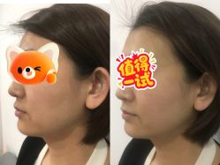 -黎蓓露·徒手骨雕蛋白抗衰·调肤管理