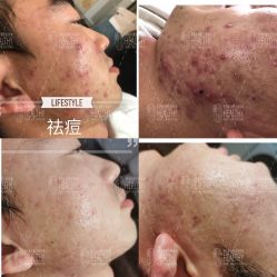 -阅年轻·AI家庭健康体质调理