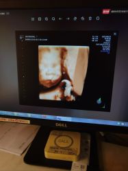 -重庆安琪儿妇产医院-妇幼保健联盟医院