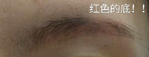 -伊丽莎白医疗美容