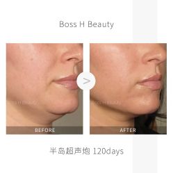 -Boss H Beauty美肌中心