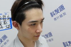 点击看大图 -大麦微针植发丨全国连锁