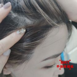-碧莲盛·不剃发植发
