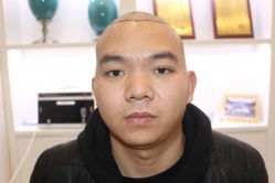 点击看大图 -大麦微针植发丨全国连锁
