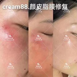 -Cream88颜皮肤管理中心