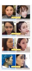 -鑫元辰医疗美容整形