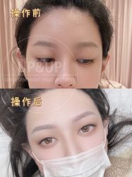 -UP&UP·半永久眉毛眼线机器野生眉