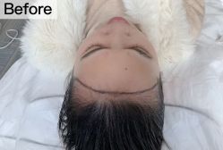 -西施无菌半永久纹绣眉眼影唇轻增发纹发际线