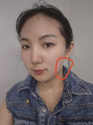 -广州美莱医疗美容医院