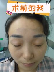 -素美医疗美容·西南眼鼻整形·修复基地