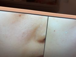 -苑苑vbeauty科技美容SPA