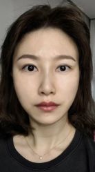 体验后-南京康美美容医院·旗舰店