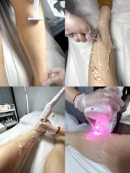 -植蔻妍皮肤管理美肤中心