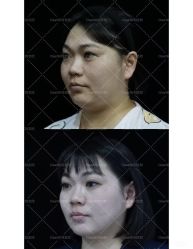 -洁铭新加坡医美