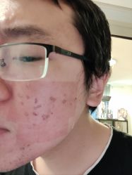 -铂特丽医美·眼鼻整形·光电美肤·注射抗衰