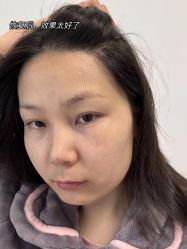 -雍禾植发全国连锁