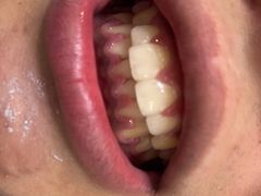 -宁波壹加壹口腔·矫正种植中心