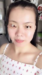 -苗方清颜专业祛痘