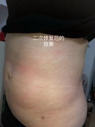 -Yestar艺星医疗美容医院