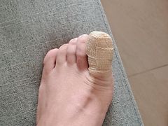 -世龙世家灰指甲鸡眼脚气甲沟炎跖疣护理(通州店)