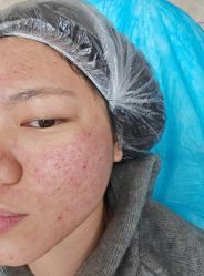 -长沙雅美医疗美容医院