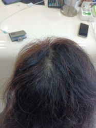 -新生植发·植养护一体