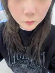 -苗医生0感科技祛痘