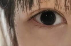 点击看大图 体验后-温州伯思立医院