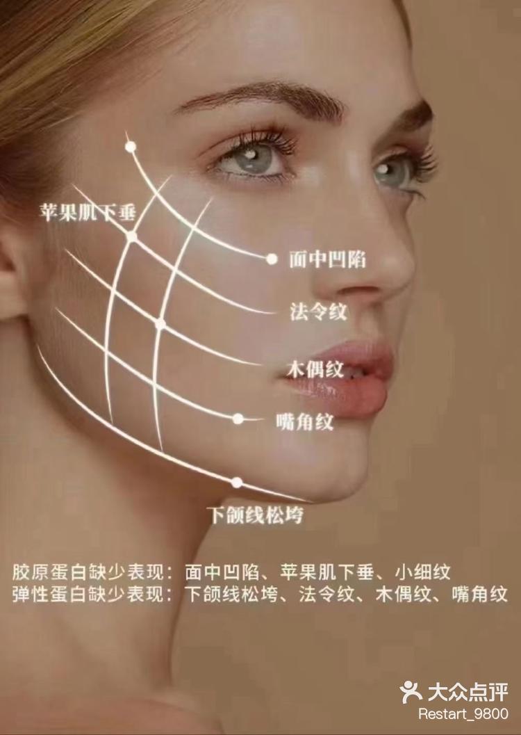 ✨——什么叫下颌线? 下颌线也叫轮廓线