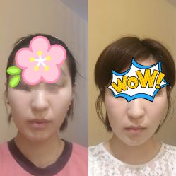 -小颜秘家·韩国整骨