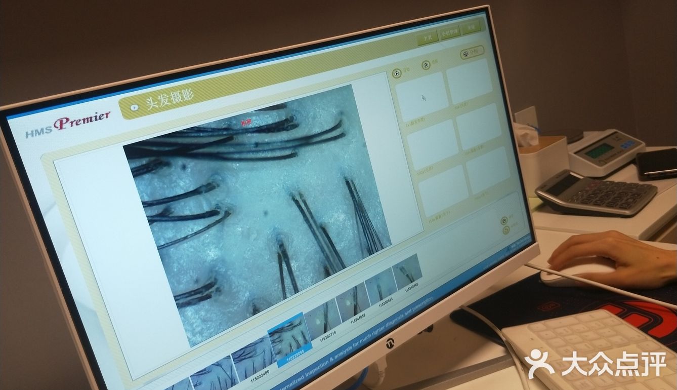 首次体验头皮护理[胜利]