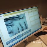 首次体验头皮护理[胜利]