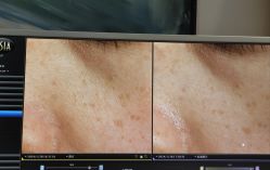 体验前-苑苑vbeauty科技美容SPA