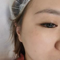 体验前-Yestar宁波艺星整形医院