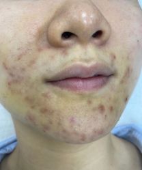-元熙兰积皮肤管理