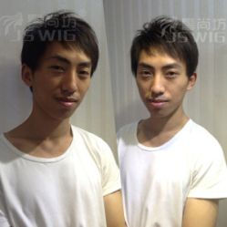 男士补发效果-髻尚坊增发补发织发假发定制