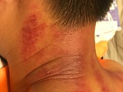 -御一坊盲人推拿(青年路店)