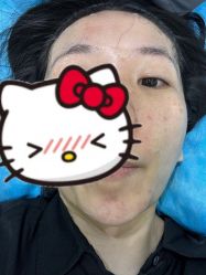 -嘉和医学脱毛中心