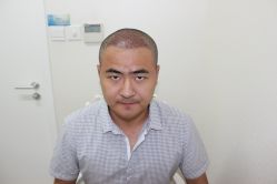 点击看大图 -大麦微针植发丨全国连锁