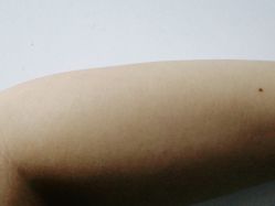 -厦门美莱整形美容医院