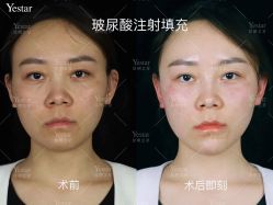 -Yestar艺星医疗美容医院