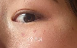 -美莱医学美容医院