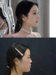 -成都西区医院整形美容