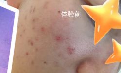 体验前-慕颜医疗美容·皮肤微整 抗衰