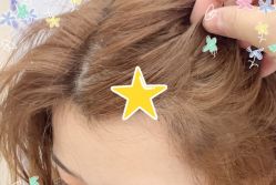 -大麦微针植发全国连锁