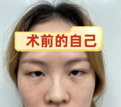 -素美医疗美容·西南眼鼻整形·修复基地
