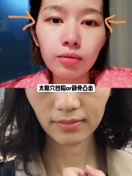 -美莱医学美容医院